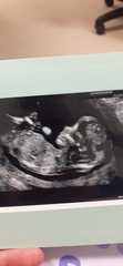 chances of having all the same gender?