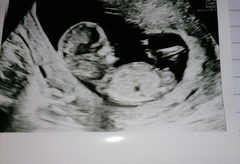 Do you want me to guess the sex? 12 week scans.