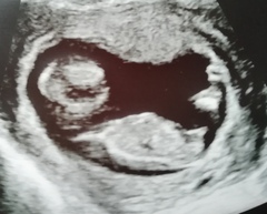 Gender guess - skull/nub?