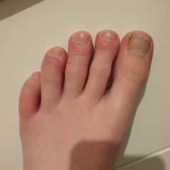Covid Toe
