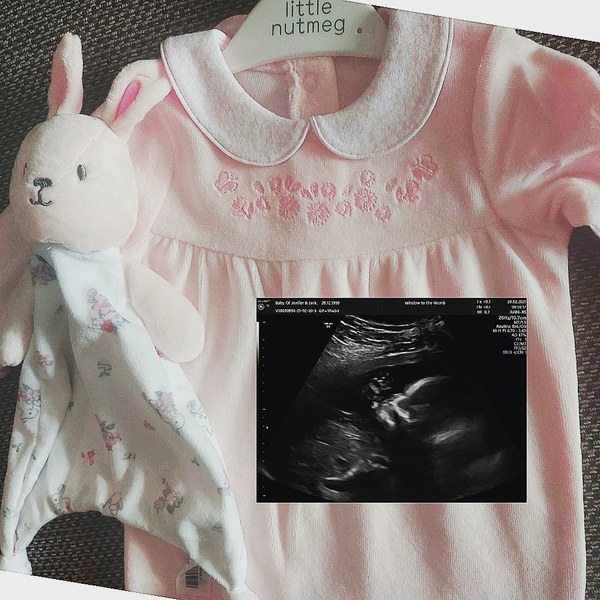 Do you want me to guess the sex? 12 week scans.