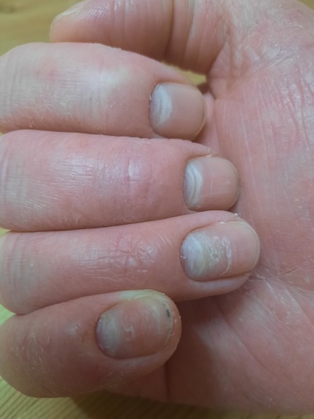 Any dermatologists about?