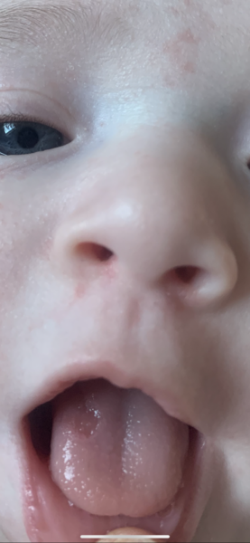 Chunk missing from DDs tongue?