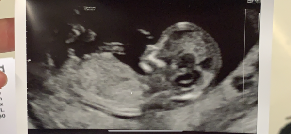 Boy or girls???