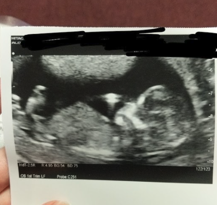 Do you want me to guess the sex? 12 week scans.