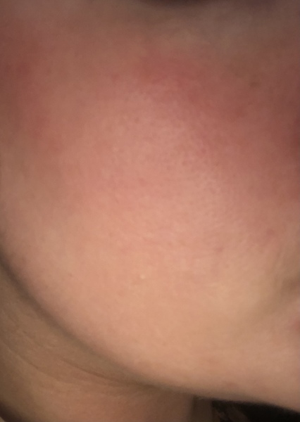 🐌 Fantastic Skincare: Jump through flaming hoops, repeat, 'Beauty is Pain', and acces to this thread will be unlocked