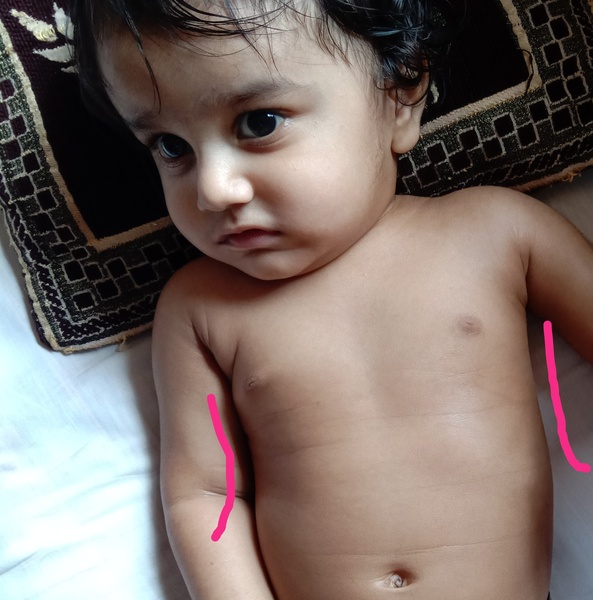 Does my baby's ribcage seem normal ? Am I overthinking