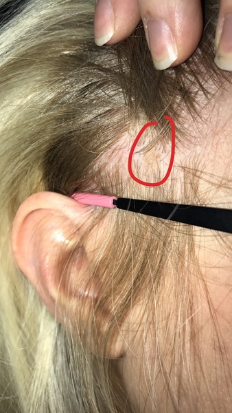 Anyone know what this could be on my scalp?