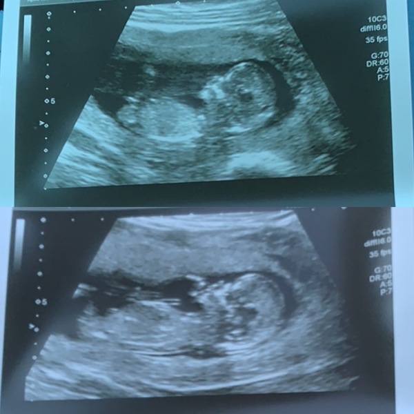 Any gender guesses? 🤞🏼