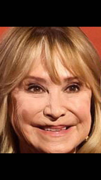 Actresses -  Feel so cross - ruined by plastic surgery