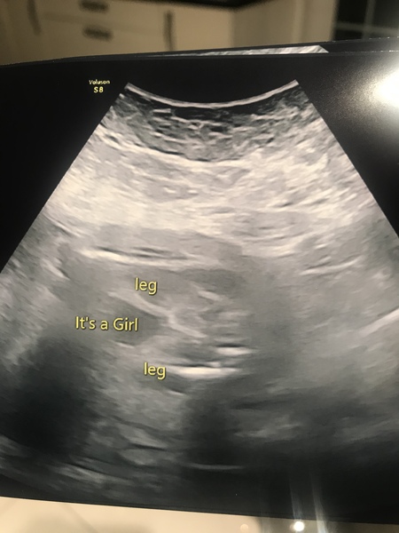 Help !! I see boy parts not a girl ?
