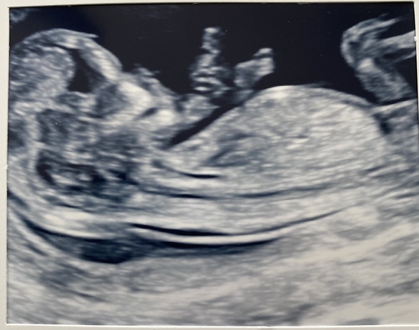 Do you want me to guess the sex? 12 week scans.