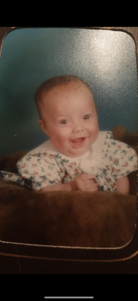 Very very large head circumference