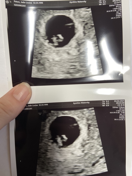 First baby due September 2021