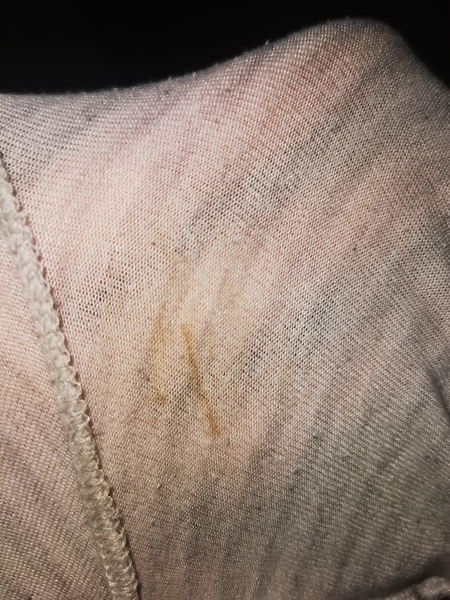 Spotting or dried discharge? TMI