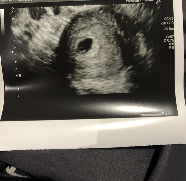 Private early scan?