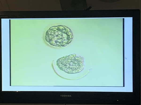 IVF January/February  2021? continued