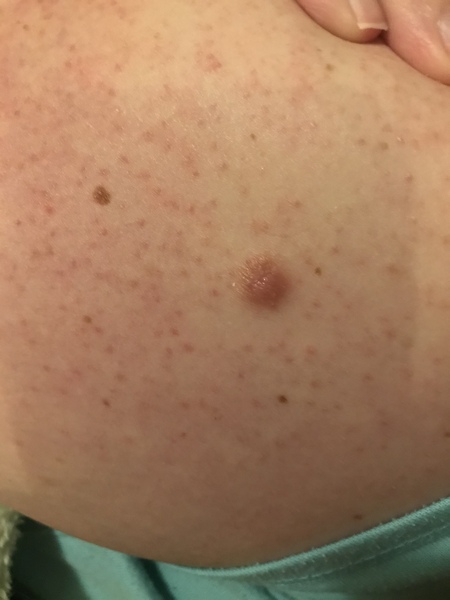 Help ! Does this look like chicken skin ?