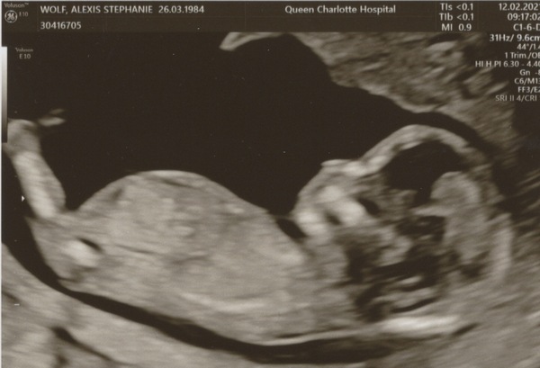 August 2021 - Scans and booking in!