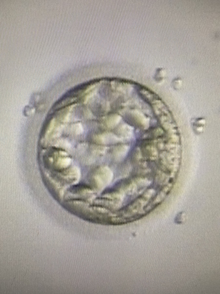 IVF January/February  2021? continued
