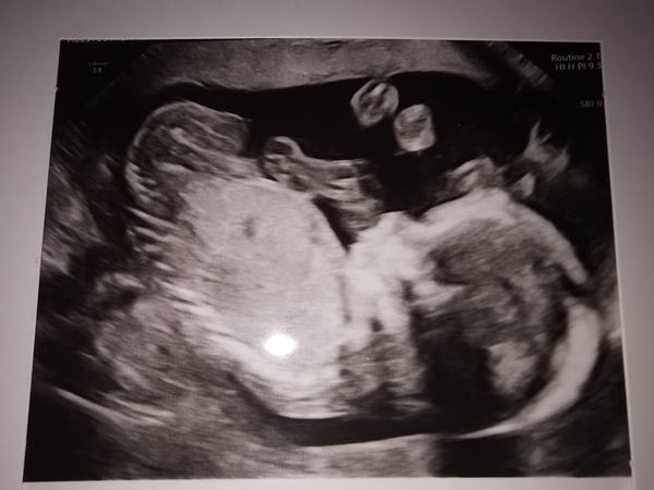 IVF graduates due Summer 2021