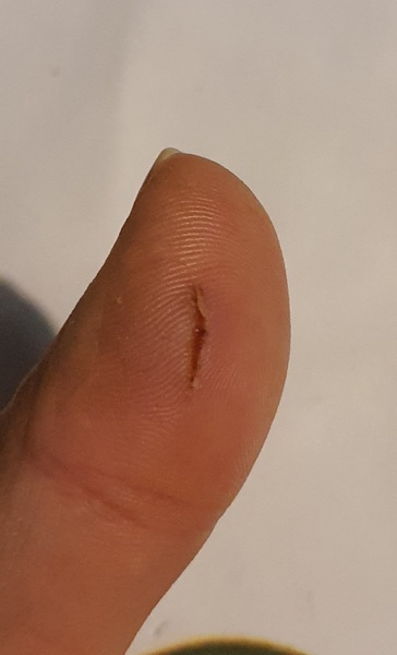 Does this look infected?