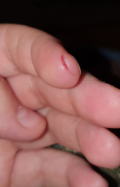 Does this look infected?