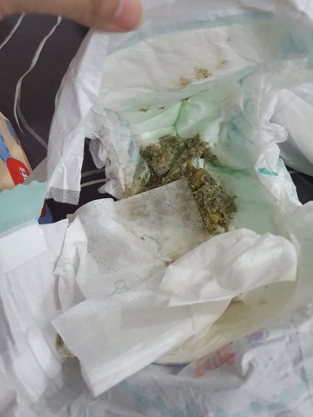 Baby green poop *WARNING* nappy photo
