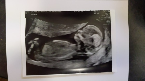Do you want me to guess the sex? 12 week scans.