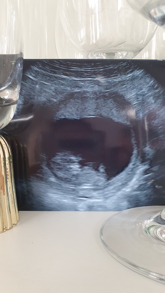 Am I going to miscarry? Scared and frightened