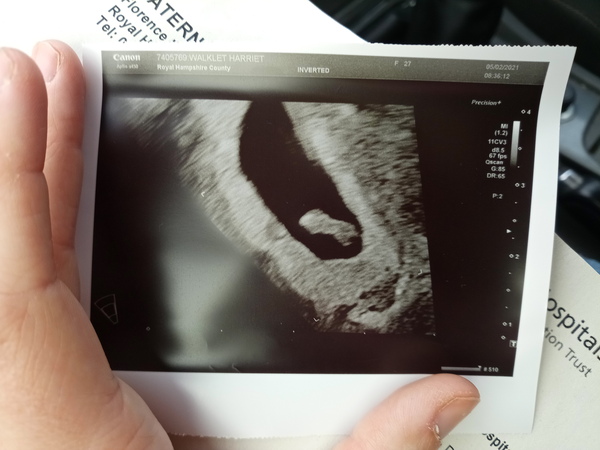 Light bleeding at 7 weeks?
