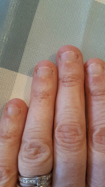 Please help me stop nail biting!