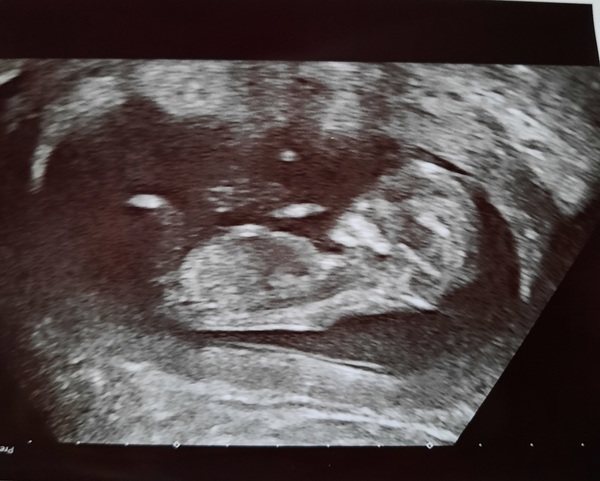 August 2021 - Scans and booking in!