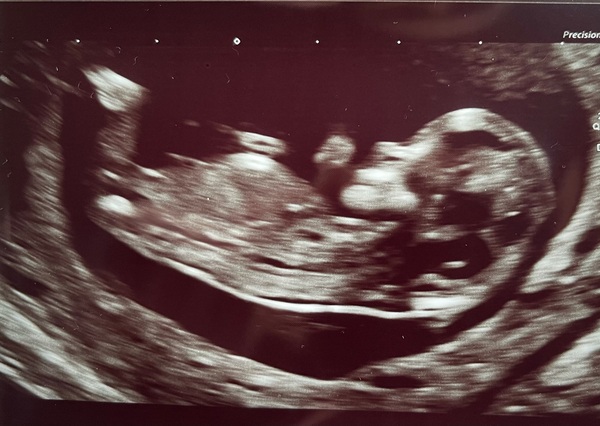 Do you want me to guess the sex? 12 week scans.