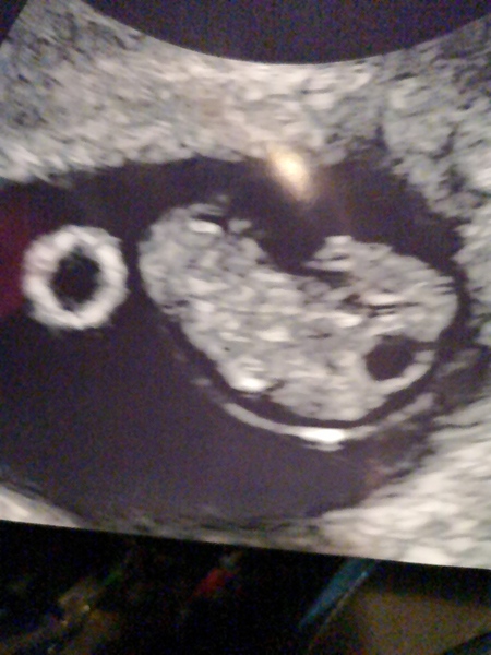 First baby due September 2021