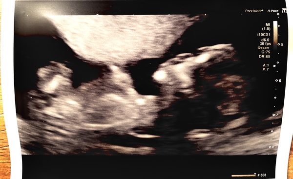Would really love your gender guesses :-)  Xx