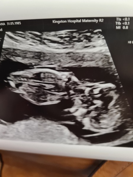 Do you want me to guess the sex? 12 week scans.