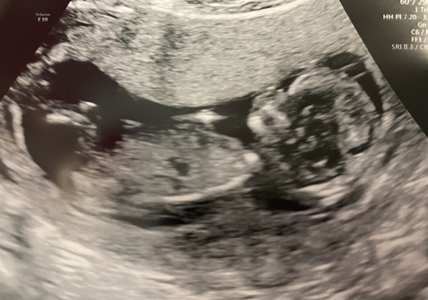 August 2021 - Scans and booking in!