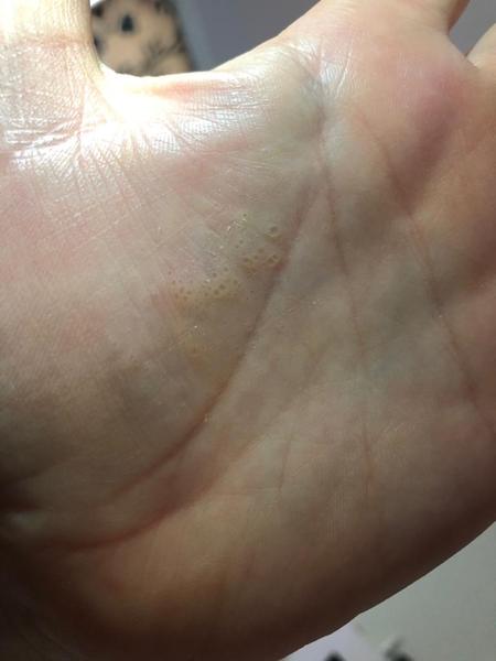 Help - What is this on my hand?