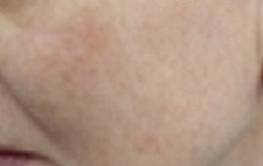 🐌 Fantastic Skincare: Jump through flaming hoops, repeat, 'Beauty is Pain', and acces to this thread will be unlocked