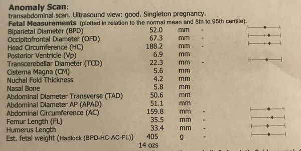 What are these percentiles?