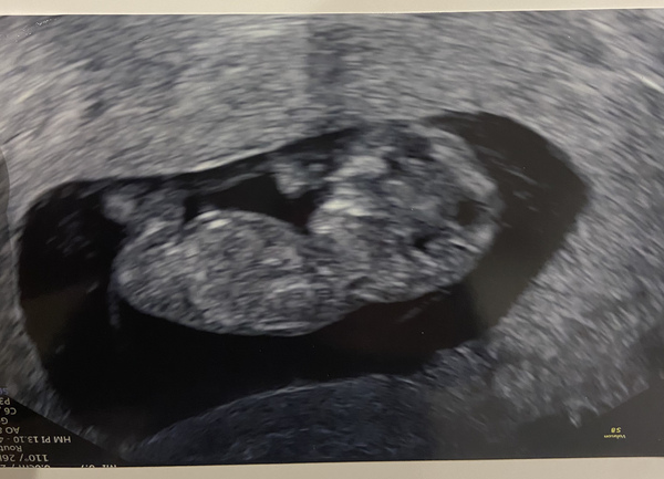 September 2021 thread 2🥳