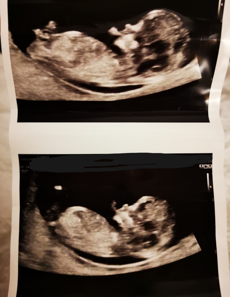 Little boy or little girl?