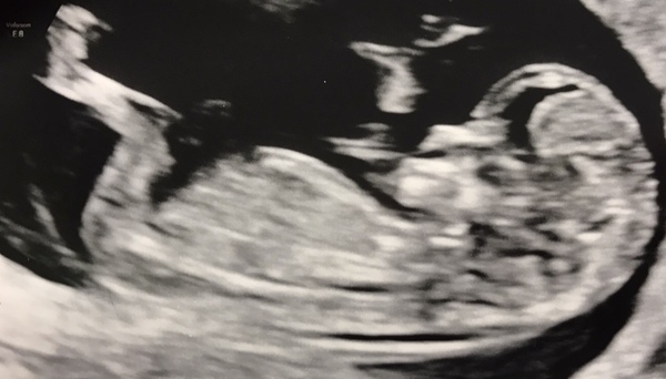 September 2021 thread 2🥳
