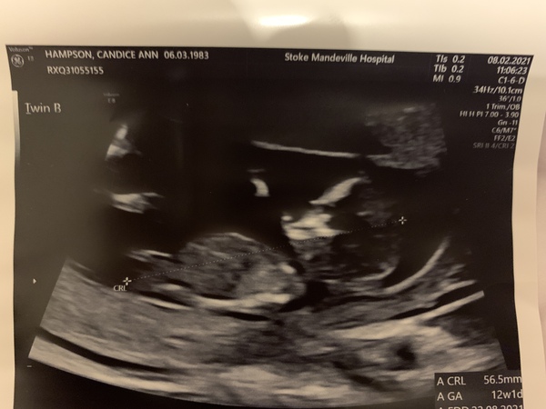 August 2021 - Scans and booking in!