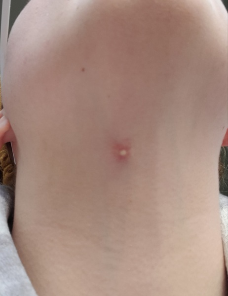 Urgent Neck Help Pic Attached