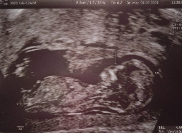 August 2021 - Scans and booking in!