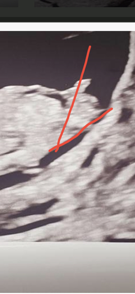 12 week scan - please can you guess the gender??