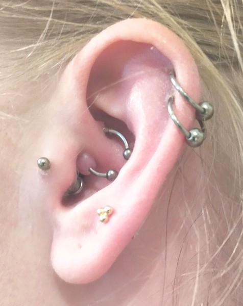 To ask how to get rid of irritation bump on tragus