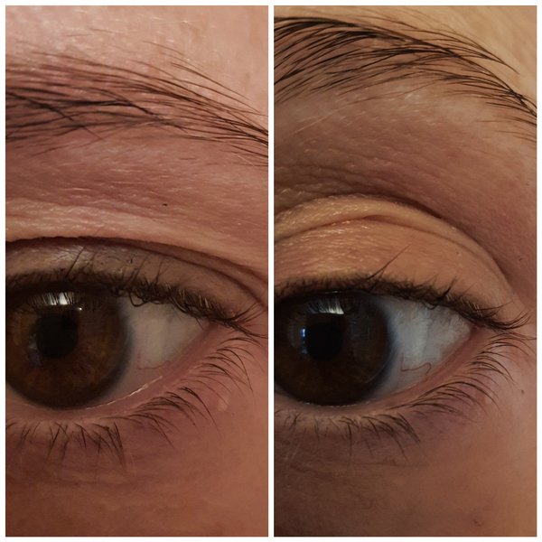 🐌 Fantastic Skincare: Jump through flaming hoops, repeat, 'Beauty is Pain', and acces to this thread will be unlocked